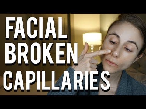 How to get rid of broken capillaries on the face| Dr Dray thumbnail