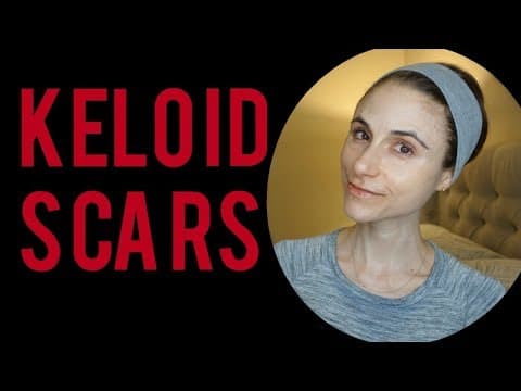 Treatments for Keloid Scars: Q&A with a dermatologist|Dr Dray thumbnail