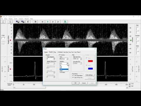 How to Analyze Pulse Wave Velocity Using DSPW Software thumbnail