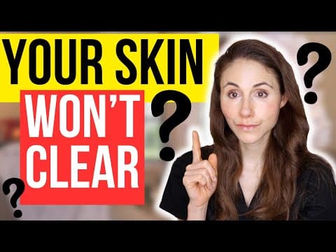 7 Reasons Why Your Skin Won't Clear thumbnail