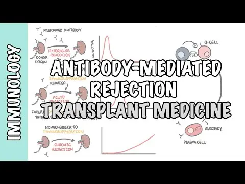 Transplant Medicine - Antibody mediated rejection thumbnail