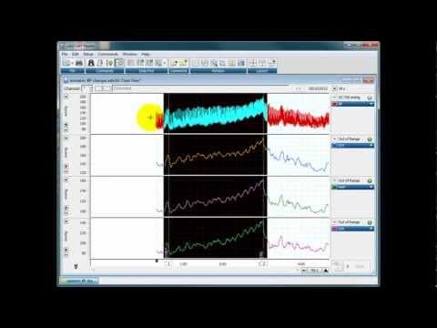How to Calculate Systolic, Diastolic, and Mean Blood Pressure thumbnail