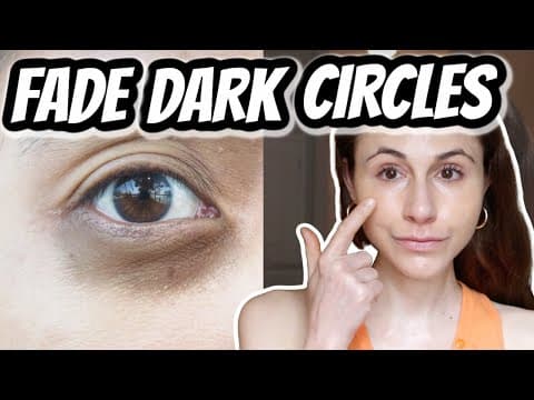 How to Fade Dark Circles Under Your Eyes Effectively? thumbnail