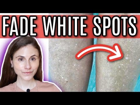 How to Fade White Spots from Sun Damage Effectively thumbnail