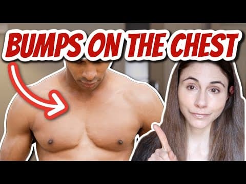 What Are Eruptive Vellus Hair Cysts and How to Treat Them? thumbnail