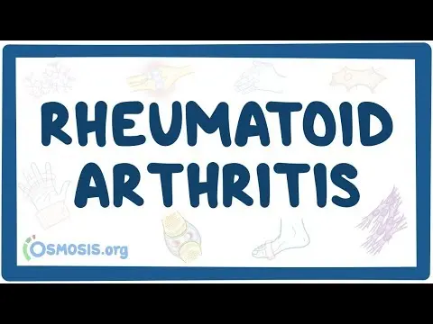 Rheumatoid arthritis - causes, symptoms, diagnosis, treatment, pathology thumbnail