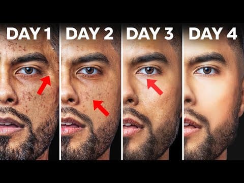 How To Fix Your Skin in 4 Days (Use At Home Products) thumbnail