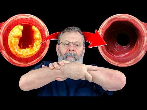Сосуды очистятся мгновенно после этого упражнения! thumbnail