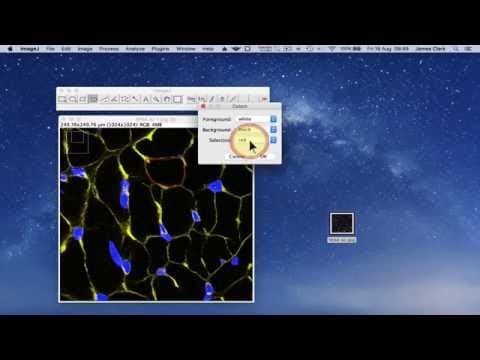 How to Use ImageJ for Cell Counting and Area Measurement thumbnail