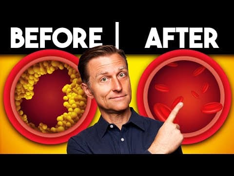 What Meal Can Help Clear Arteries Effectively? thumbnail