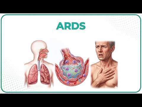 Acute respiratory distress syndrome ( ARDS ) Etiology, Clinical features, Diagnosis, and Treatment thumbnail