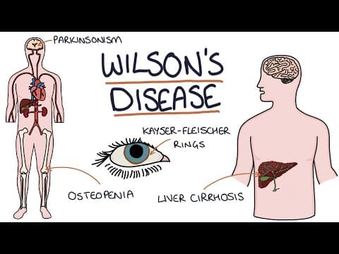 Understanding Wilson's Disease thumbnail