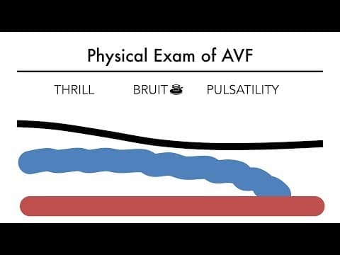 What is a Radial Cephalic AV Fistula Exam Like? thumbnail