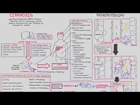 Liver Cirrhosis (SandS, Pathophysiology, Investigations, Management) thumbnail