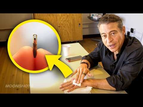 I Put a Microchip in My Hand. Here’s Why thumbnail