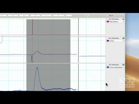 Extracting and Plotting data with a variable baseline in LabChart to Prism thumbnail