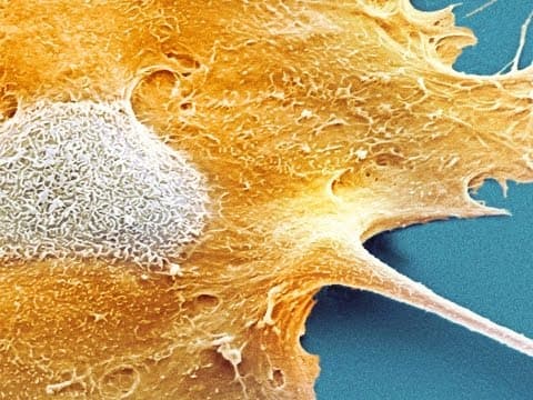Why Don't We All Have Cancer? thumbnail
