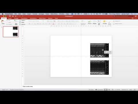 Editing M-Mode ultrasound images for creating a figure in Powerpoint thumbnail