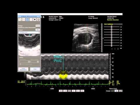 How Does 1D Cardiac Ultrasound Work with VEVO 770? thumbnail