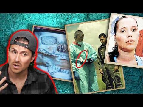What happened to their heads will have you scared for YOURSELF (*WARNING*) thumbnail