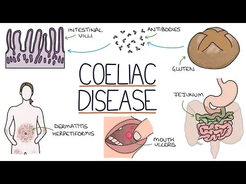 Understanding Coeliac Disease thumbnail