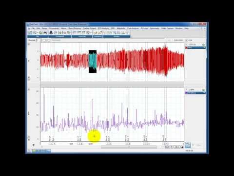Calculating rates from Respiratory Traces thumbnail