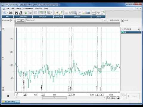 Automatically find a point and select Data in LabChart thumbnail