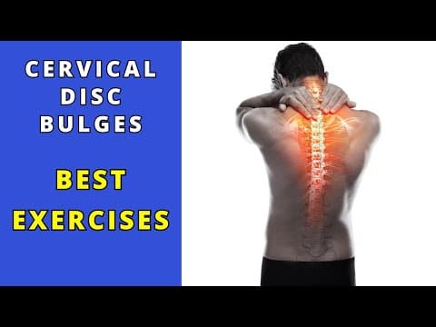 Cervical Disc Bulges best rehab exercises. thumbnail