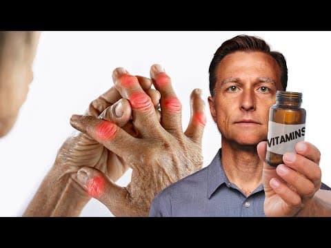 The #1 Best Vitamin for Arthritis (NOT VITAMIN D) thumbnail