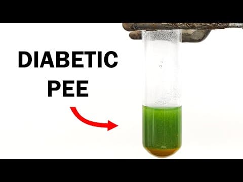 What Is the History of Diabetes Testing Methods? thumbnail