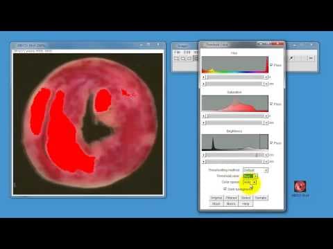 How to Measure Histological Areas Using ImageJ thumbnail
