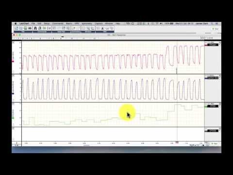 Determining End Tidal O2 and CO2 from tidal gas tracesEnd Tidal Gas measurements thumbnail