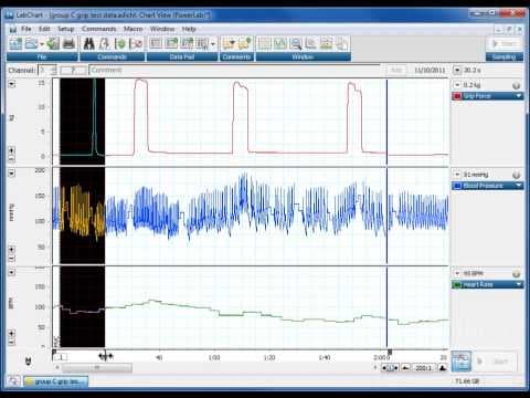 How to Use Comments in LabChart for Accurate Data Navigation thumbnail