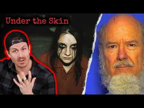 Top 3 Most Disturbing Ways To Get Yourself Sick thumbnail