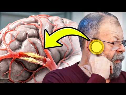 ПОКАЗЫВАЮ КАК БЫСТРО ОЧИСТИТЬ СОСУДЫ МОЗГА 5 УПРАЖНЕНИЯМИ thumbnail