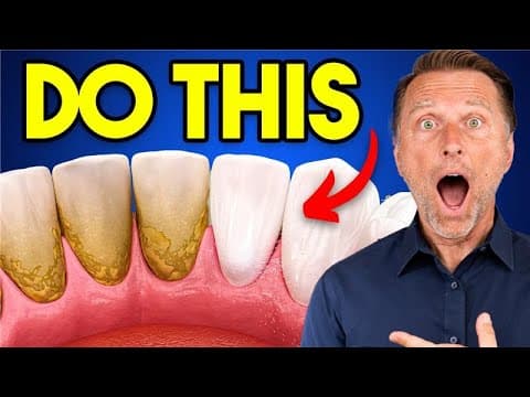 The #1 BEST Remedy for Dental Plaque (TARTAR) thumbnail